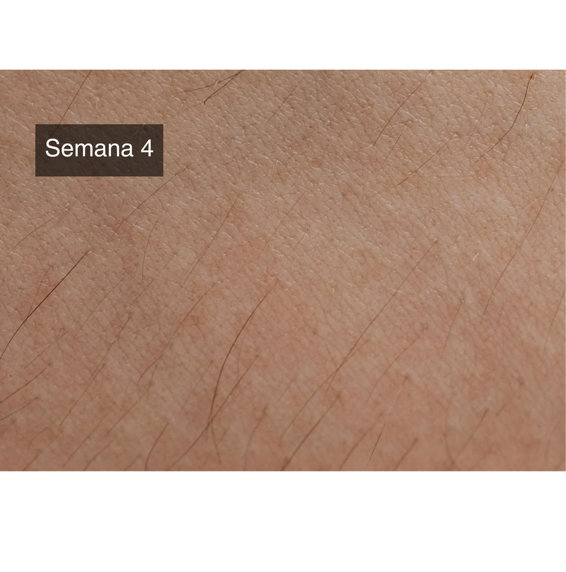 Piel más suave y regeneración más lenta